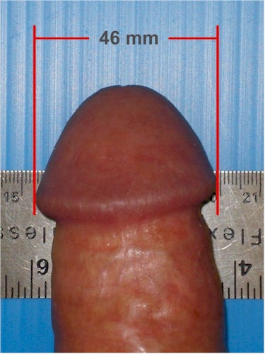 Penis Example 16