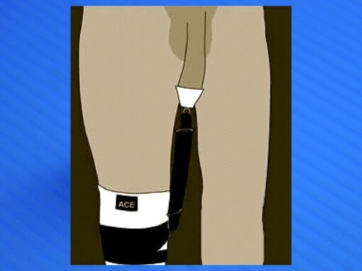 Ace Knee Brace worn for strapping comfort